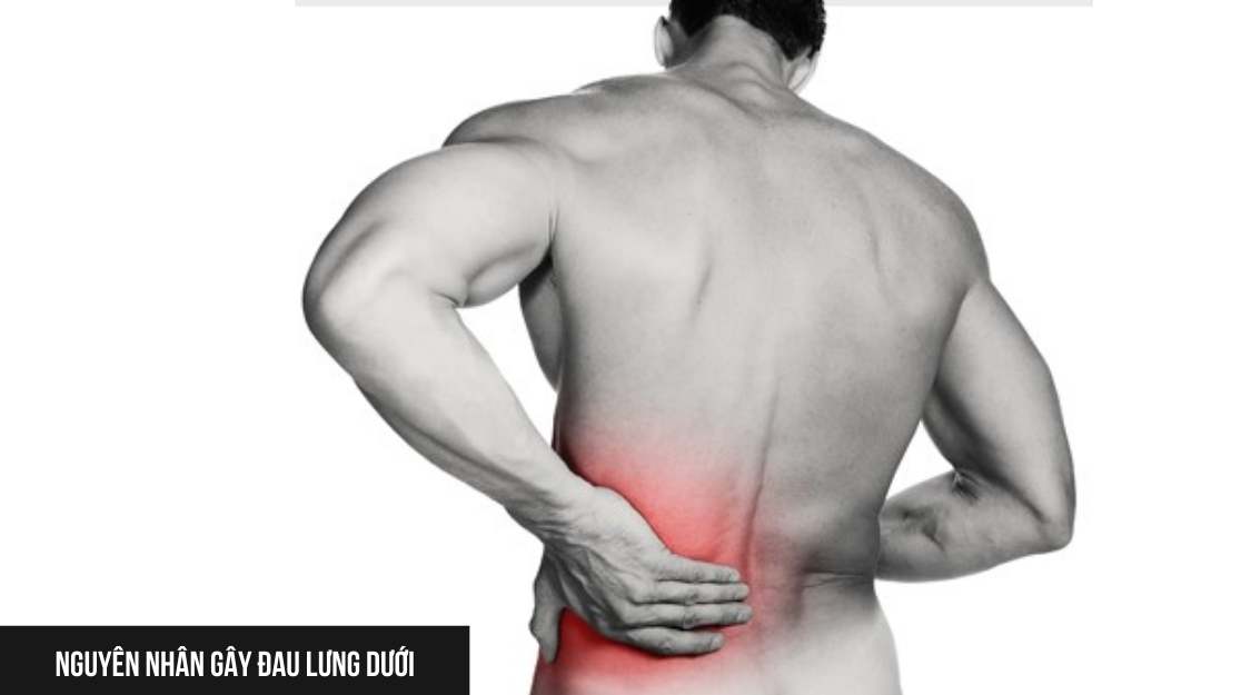 Nguyên nhân gây đau lưng dưới