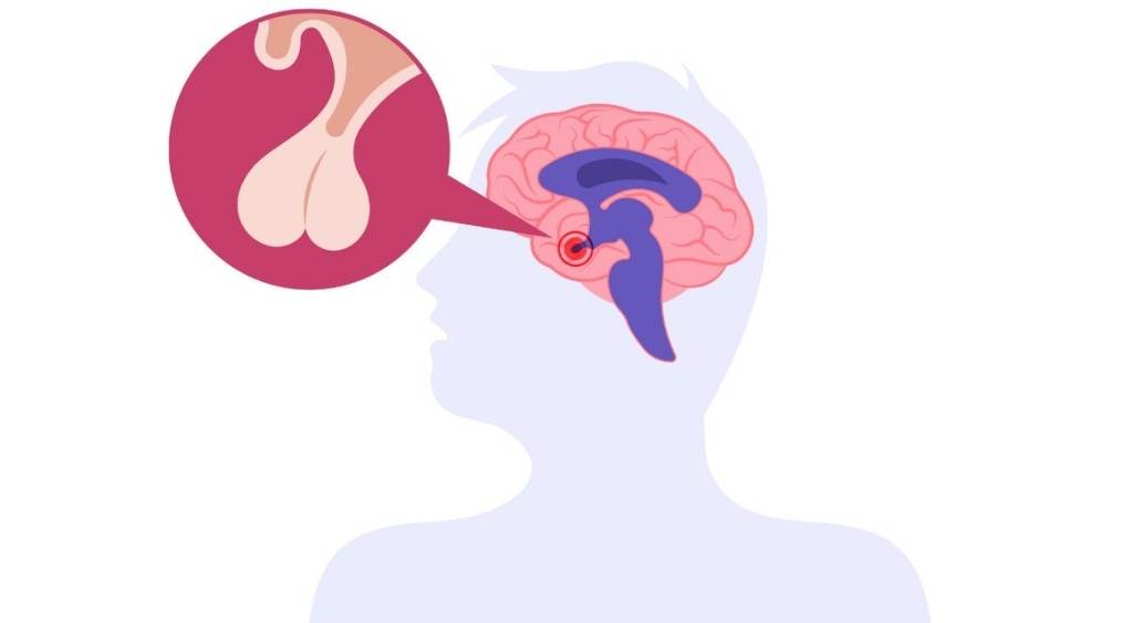 suy giảm testosterone ở người trẻ